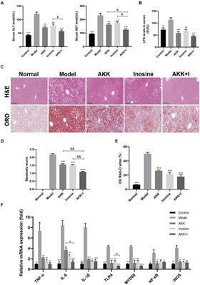 Symbiotic combination of Akkermansia muciniphila and inosine alleviates alcohol-induced liver injury by modulating gut dysbiosis and immune responses